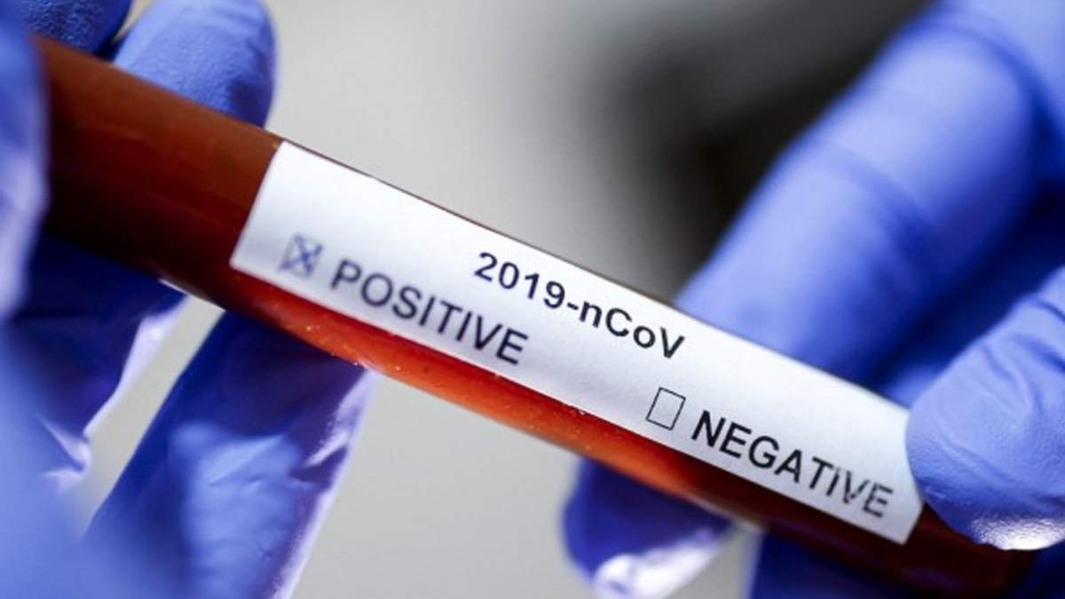 Coronavirus. Fuente: (Twitter)