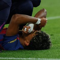 Lamine Yamal se pierde resto de la temporada del Barcelona, pero estará listo para el Mundial