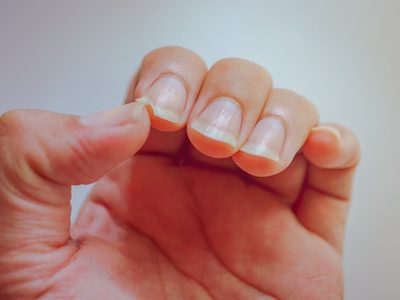 Como lo hacían las abuelas: eliminá tus uñas quebradizas con solo 1 ingrediente que tenés en la cocina