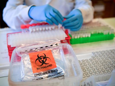 Coronavirus en Argentina: científicos avanzan en un tratamiento para curar a los enfermos