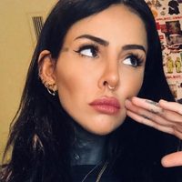 ¡De no creer! Cande Tinelli y el retoque en el rostro que la dejó deforme. ¡Mírala!