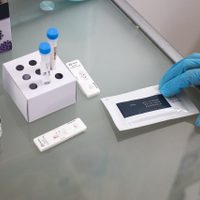 El número de casos de covid-19 en Europa baja 22% en la última semana de julio