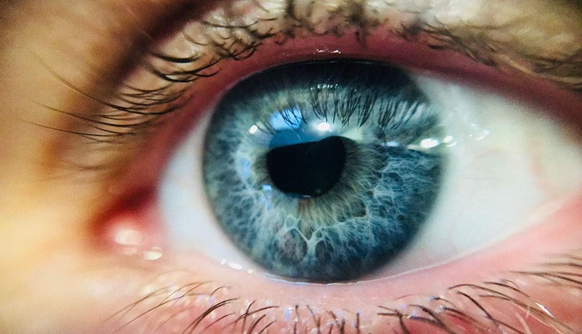 Ojos