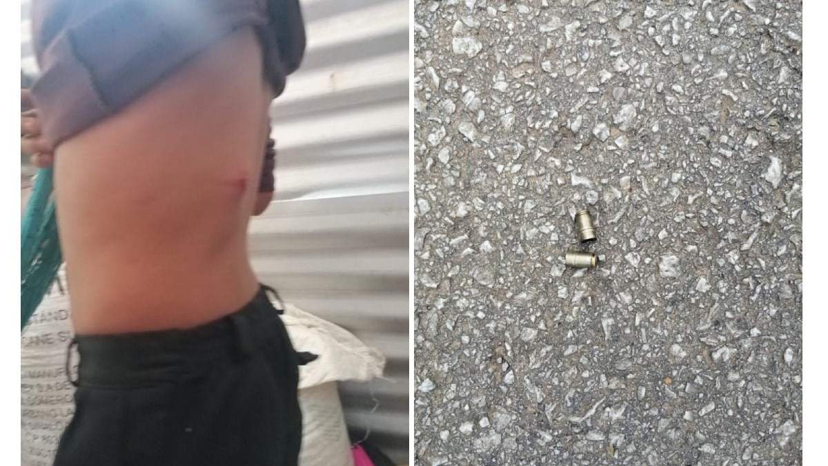 Herido de bala