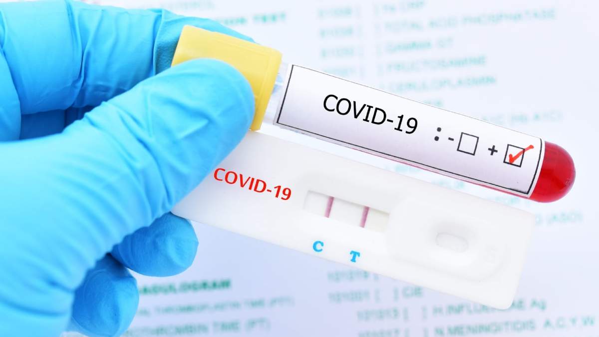 Testeo de coronavirus. Fuente: (Twitter)