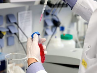 Rusia espera empezar a producir vacunas contra el coronavirus entre septiembre y octubre