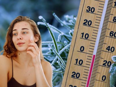 Nutrición y clima frío: alimentos que pueden ayudar a prevenir la piel seca en invierno