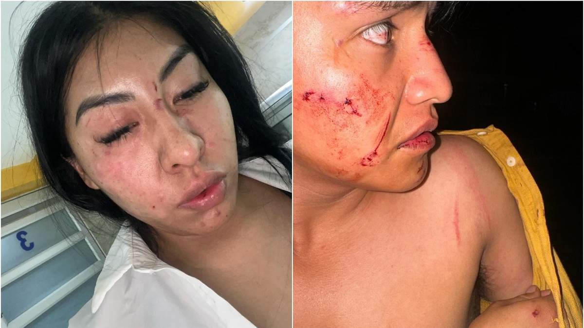 Golpiza a pareja