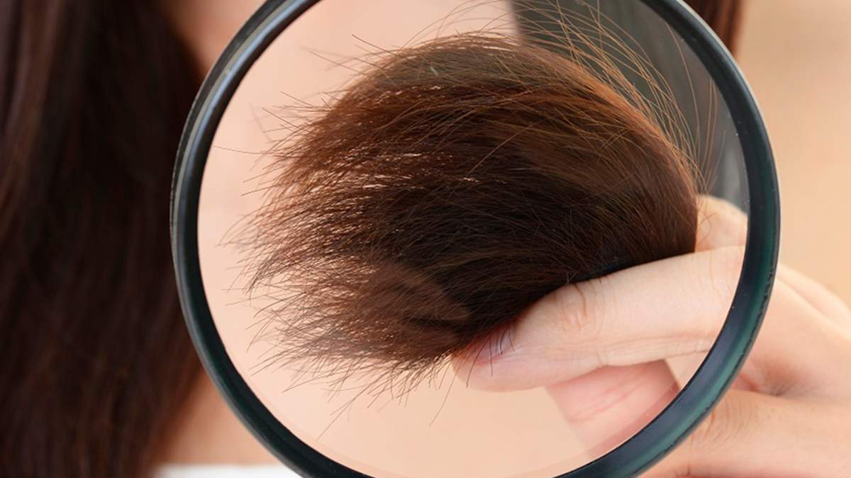 Cabello. Fuente: (X)