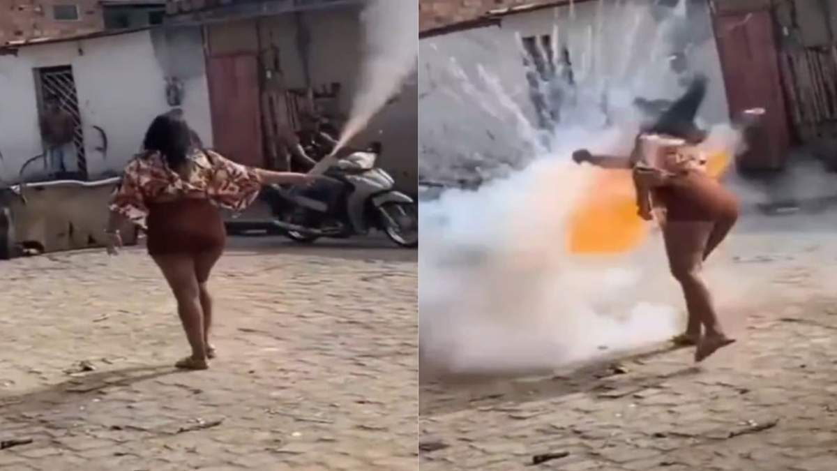 Joven de 21 años sufre traumatismo facial por explosión de pirotecnia durante festejo de San Juan en Cruz das Almas.