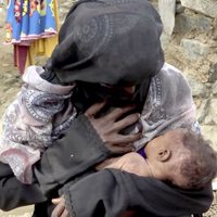 Malnutrición infantil: Nueva arma de guerra