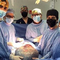 A una mujer le quitan un tumor gigante de 21 kilos en el IMSS de León