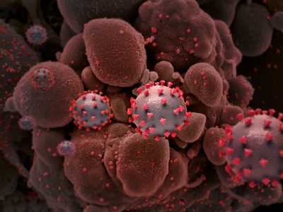 La investigación de la Inteligencia de EU no puede determinar el origen del coronavirus
