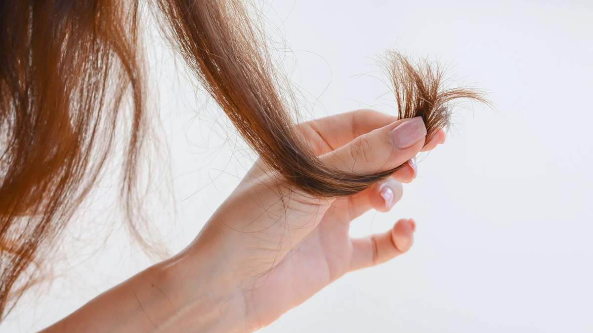 Cabello. Fuente: (X)