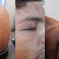 Brutalidad policial en Junín de los Andes: cinco jóvenes denunciaron una golpiza por parte del GEOP