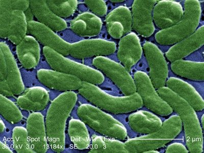 Bacteria hallada en moluscos crudos es vinculada a muerte de una persona en NY