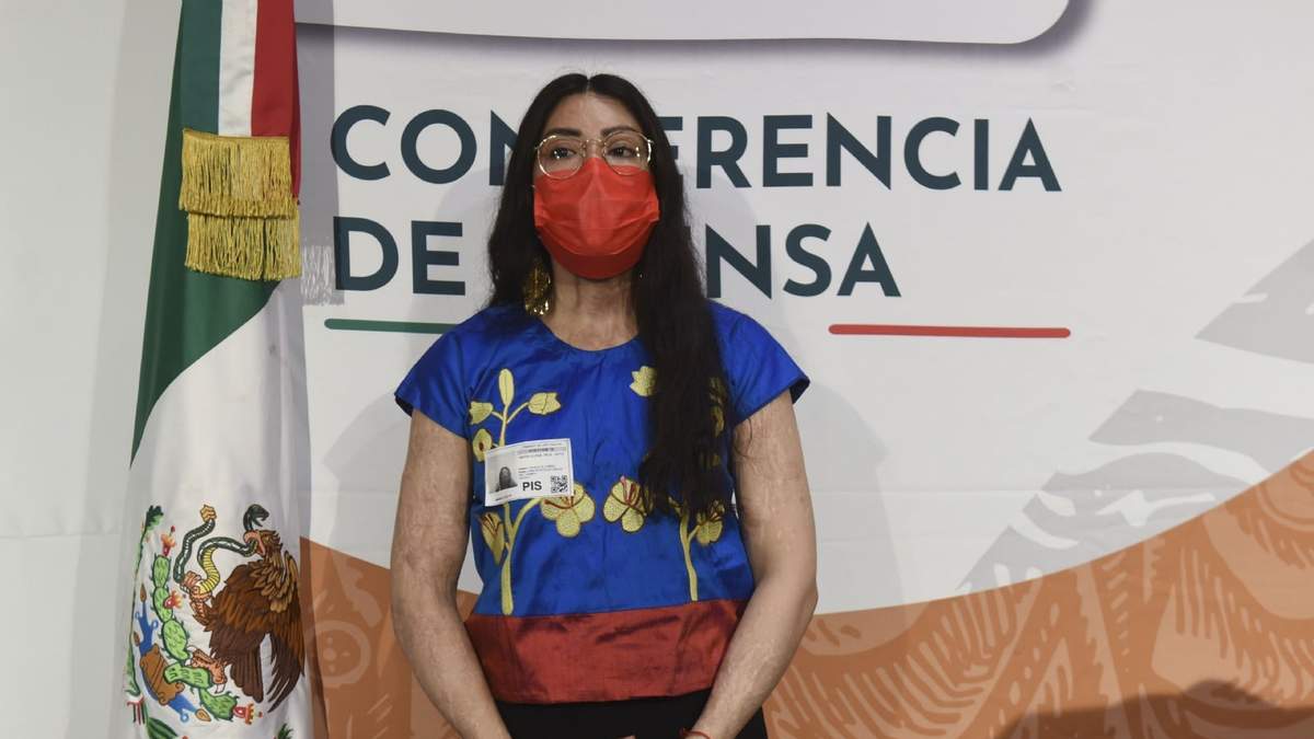 La saxofonista María Elena Ríos, víctima de un ataque con ácido