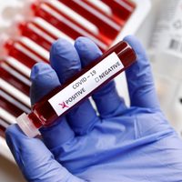 Ya se realizan testeos para detectar casos de coronavirus en la Ciudad de Buenos Aires