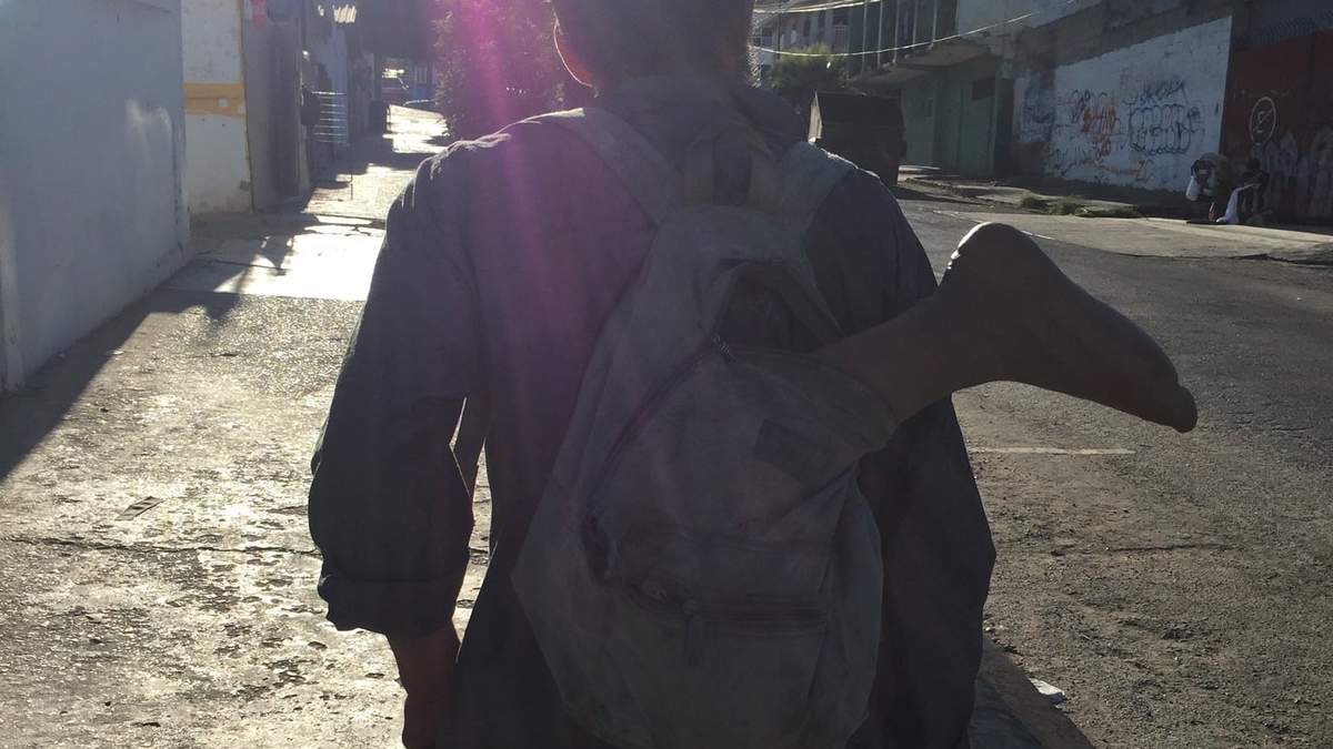 Hombre con una pierna de utilería