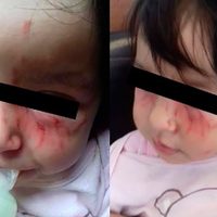 Sedesol suspende guardería en Morelia por agresiones a una niña