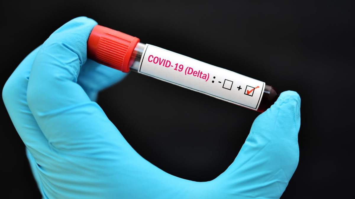 Pandemia de coronavirus en Brasil. Fuente: (Twitter)