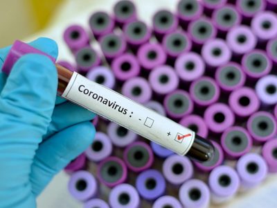 Coronavirus: el nuevo síntoma que puede determinar un contagio