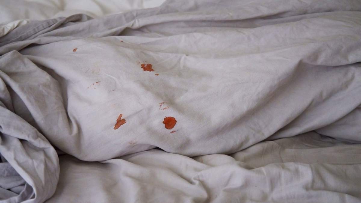 Manchas de sangre. Fuente: (Clorox)