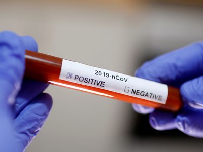 Neuquén: otro paciente fallecido y 14 nuevos casos de coronavirus