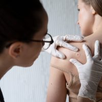 Cáncer de piel: la importancia del diagnóstico temprano