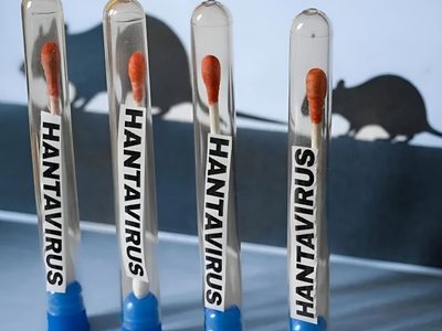 Chubut confirmó un caso de hantavirus en medio del temor mundial por el brote