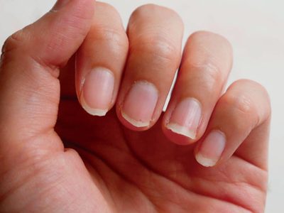 Nail Art: con 1 ingrediente de la cocina, mirá este truco de las abuelas para decirle adiós a las uñas quebradizas