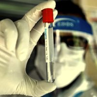 China ya patentó una vacuna contra el coronavirus