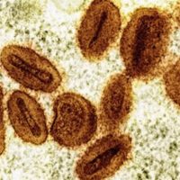 EU reporta primer contagio de nuevo tipo de viruela símica en viajero