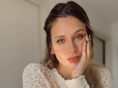 Le afectó el rostro: el doloroso problema médico de Barbie Vélez