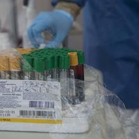 Una prueba de saliva podría acelerar el diagnóstico de un ataque al corazón, según estudio