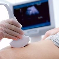 Cómo la IA puede ayudar a prevenir enfermedades y detectar cardiopatías en ecografías prenatales