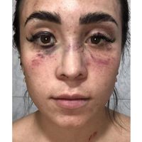Kenya Mirelle denuncia que fue golpeada por su expareja, hermano de candidata a diputada en Puebla