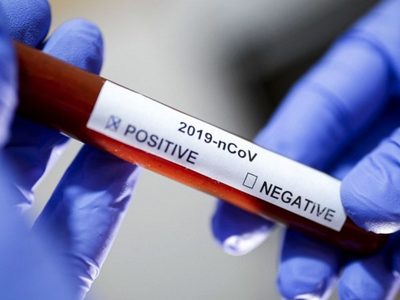 El coronavirus no se detiene en Zapala: confirman 29 nuevos casos positivos