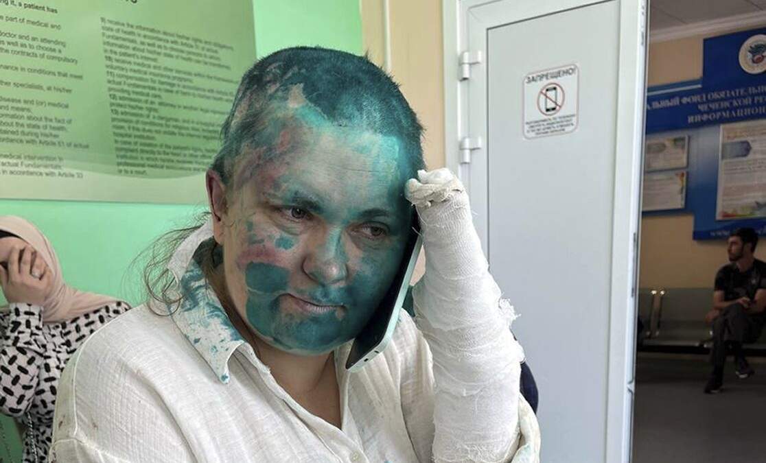 En esta imagen publicada por Novaya Gazeta Europe en su web Novayagazeta.eu el martes 4 de julio de 2023, la periodista de Novaya Gazeta Elena Milashina se ve sentada tras recibir tratamiento médico en Grozny, Rusia. Agresores enmascarados no identificados atacaron y golpearon a la periodista y un abogado en la provincia rusa de Chechenia, un incidente violento que continuaba con un patrón de abusos rampantes a los derechos humanos en la región
