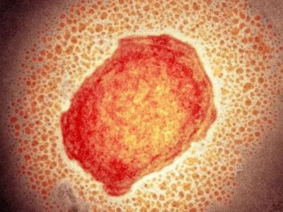 Viruela del mono: qué es, cuáles son sus síntomas y cómo se transmite