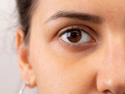 El método más efectivo para eliminar las ojeras en tiempo récord con 1 ingrediente de tu cocina