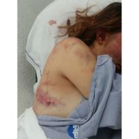 Activistas exigen protección para Andrea, joven brutalmente golpeada por su novio en Yucatán