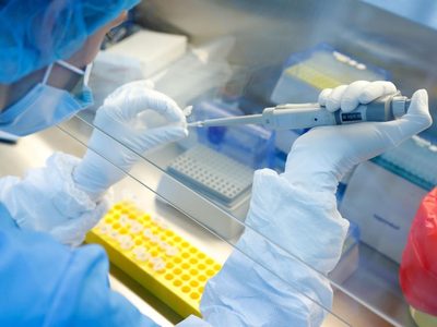 La OMS inició conversaciones con Rusia sobre la vacuna contra el coronavirus