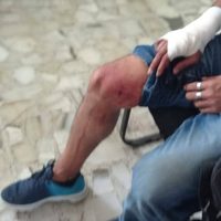 Francisco Magaña, reportero de Guerrero, sufre intento de homicidio con un arma blanca
