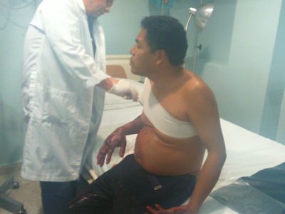 Noche de Iguala: Alfredo, un herido que no fue noticia