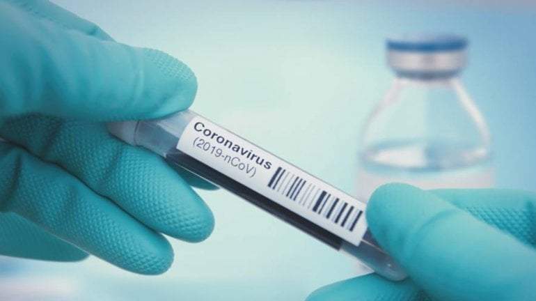 Coronavirus. Fuente: (Instagram)