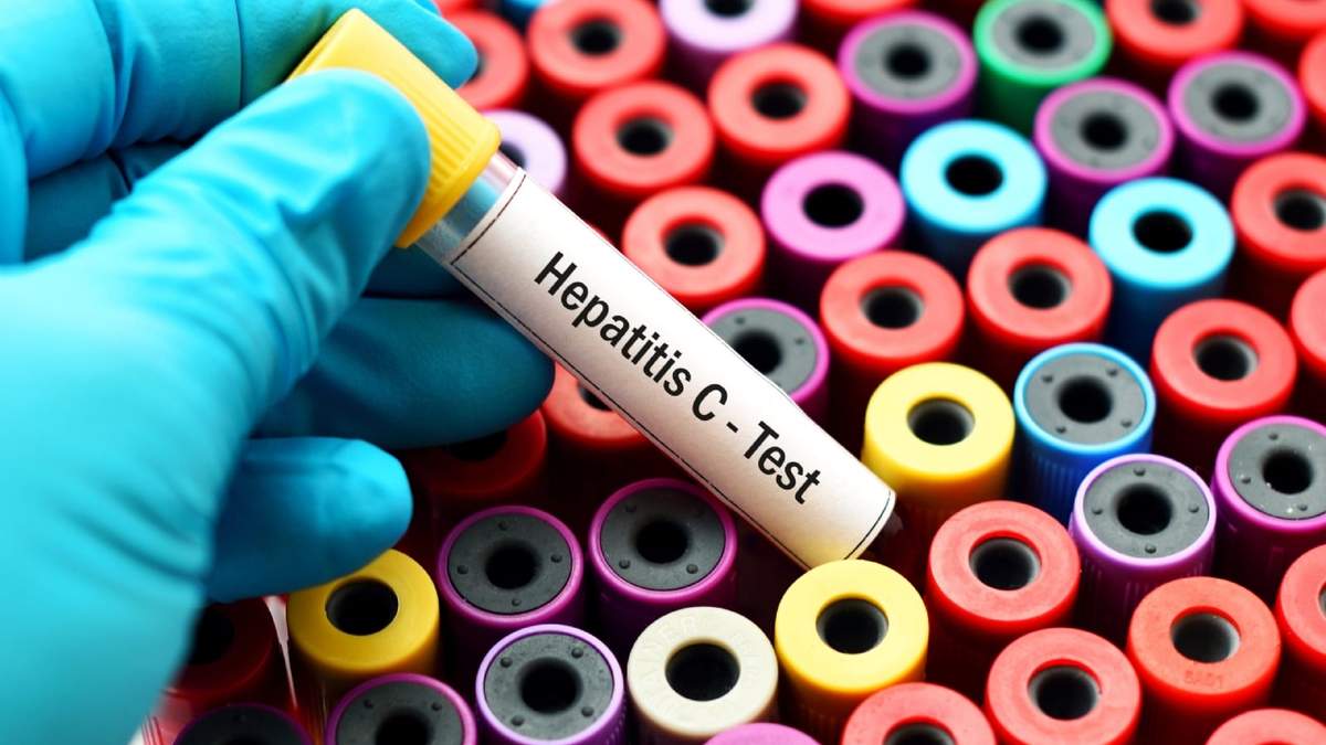 Test Hepatitis C. Fuente: (Instagram)