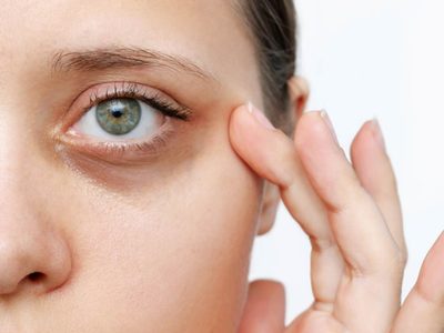 El remedio casero con Aloe Vera que ayuda a reducir las ojeras: anotá el paso a paso