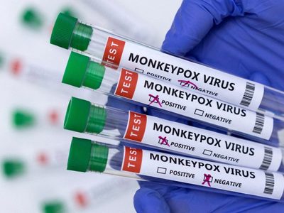 La OMS confirmó más de 600 casos de viruela del mono fuera de África