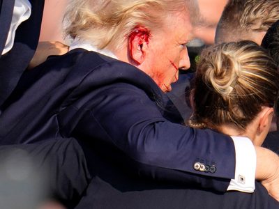 Trump y la bala mediática